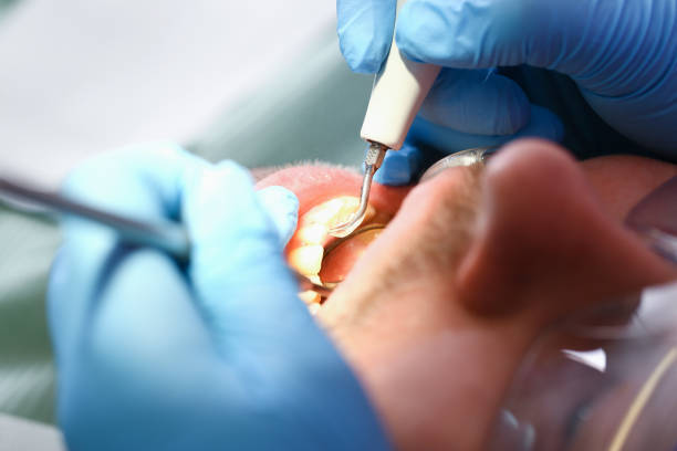 Best Emergency Dental Care for Abscessed Tooth in Maysville, NC