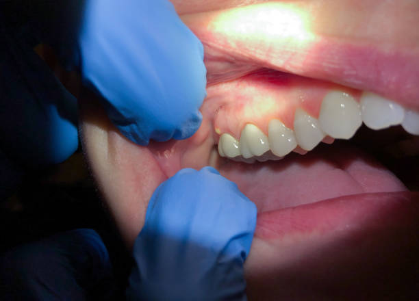 Best Orthodontic Emergency Dentist in Maysville, NC